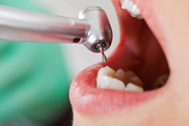 Best Tooth Pain Emergency Relief  in Falmouth Foreside, ME
